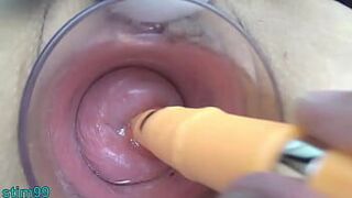 Японская милфа с шейкой матки трахается с немецким настоящим пенисом дилдо и азиатскими палочками для еды - порно видео